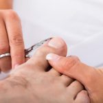 Лечение вросшего ногтя пластинами и скобами – насколько это эффективно?